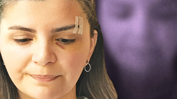 Şiddete uğrayan doktor: Kırılan yüzüm değil doktorluk&nbsp;onurum