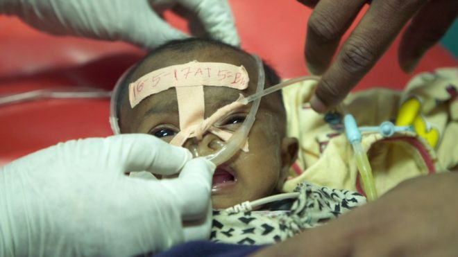 Zatürreden ölümleri şampuan şişesi ile durduran&nbsp;doktor!