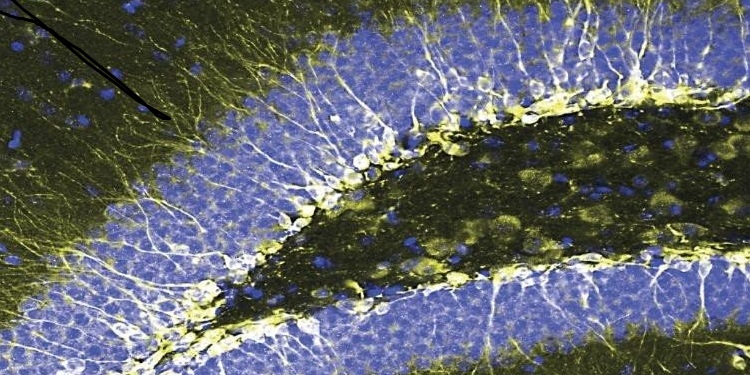 Anti-Depresan Terapiler İçin Yeni&nbsp;Güzergah