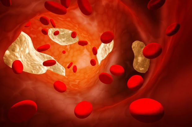 Bilim Dünyasında Yeni Araştırma: Yaşlılarda kolesterolü düşürmek anlamsız bir&nbsp;çabadır!