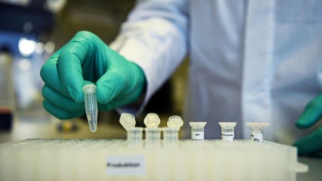 Almanya’da yüksek vaka sayısına karşın ölüm oranı neden&nbsp;düşük?