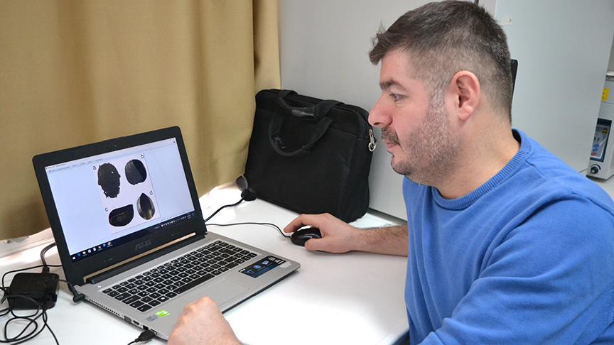 Böcek zırhından zayıflama hapı geliştirildi&nbsp;​