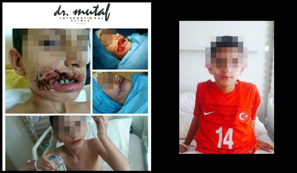 Prof. Dr. Mehmet Mutaf’tan Emrullah’ın Müthiş Değişimi ve Milli&nbsp;Forma