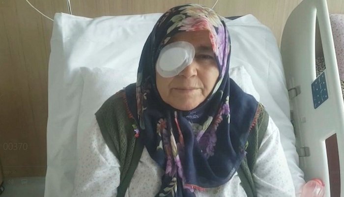 Kırıkkale’de Görme Kaybı Yaşayan Hastalar için Göz Doktorları Açıklama Yaptı: Sağlık Bakanlığı’nı 1 Yıl Önce&nbsp;Uyardık!