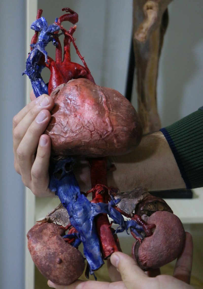 Tıp Eğitiminde Kadavra Eksikliğine Çözüm:&nbsp;Plastinasyon