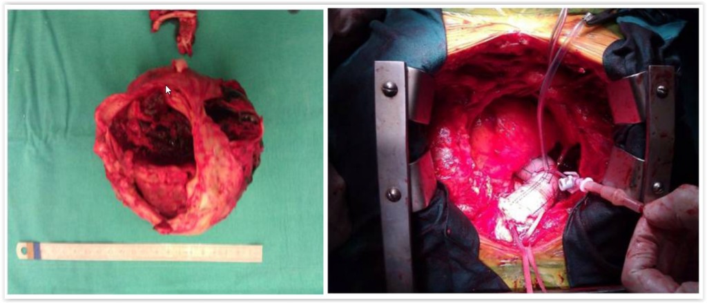 Türk Cerrah Yaptığı Ameliyat ile Dünya Tıp Literatürüne&nbsp;Girdi