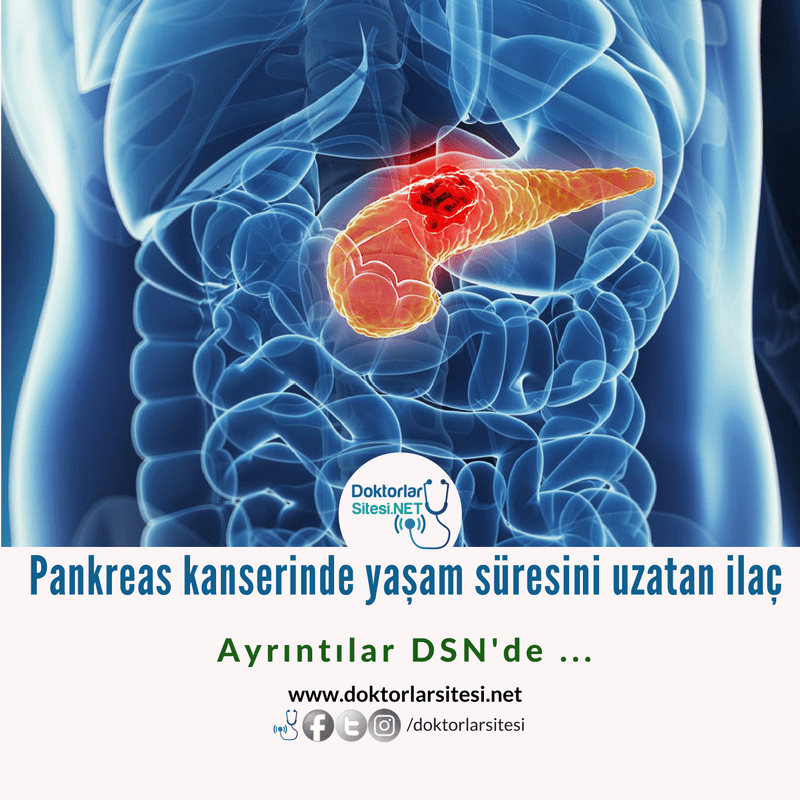Pankreas Kanserinde Yaşam Süresini Uzatan İlaç&nbsp;Keşfedildi!