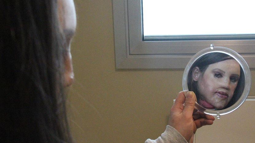 Karında doku geliştirip hastaya yeni yüz yapan Türk doktor literatüre&nbsp;girdi