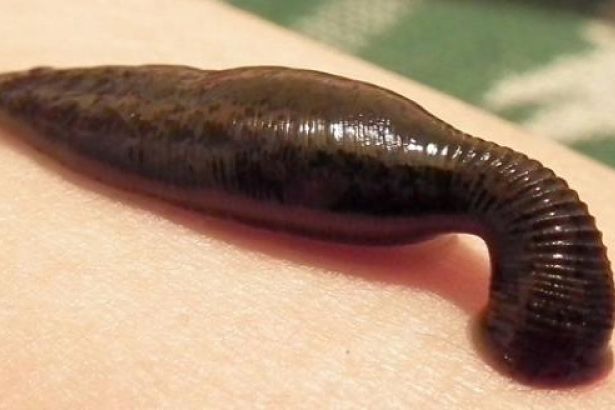 Türk Jinekoloji ve Obstetrik Derneği’nden ‘vajinal sülük’&nbsp;tepkisi