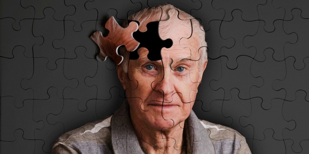 Alzheimer’dan Ölümler son 15 yılda yarı yarıya&nbsp;arttı!