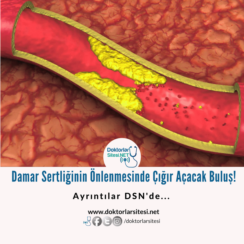 Damar Sertliğinin Önlenmesinde Çığır Açacak&nbsp;Buluş!