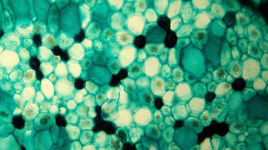 Yaşlanmayla ilgili protein&nbsp;keşfedildi