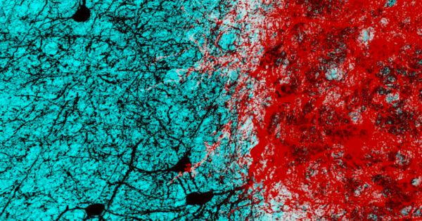 Bilimde Bugün: Korku hissini azaltmanın yolu&nbsp;bulundu!