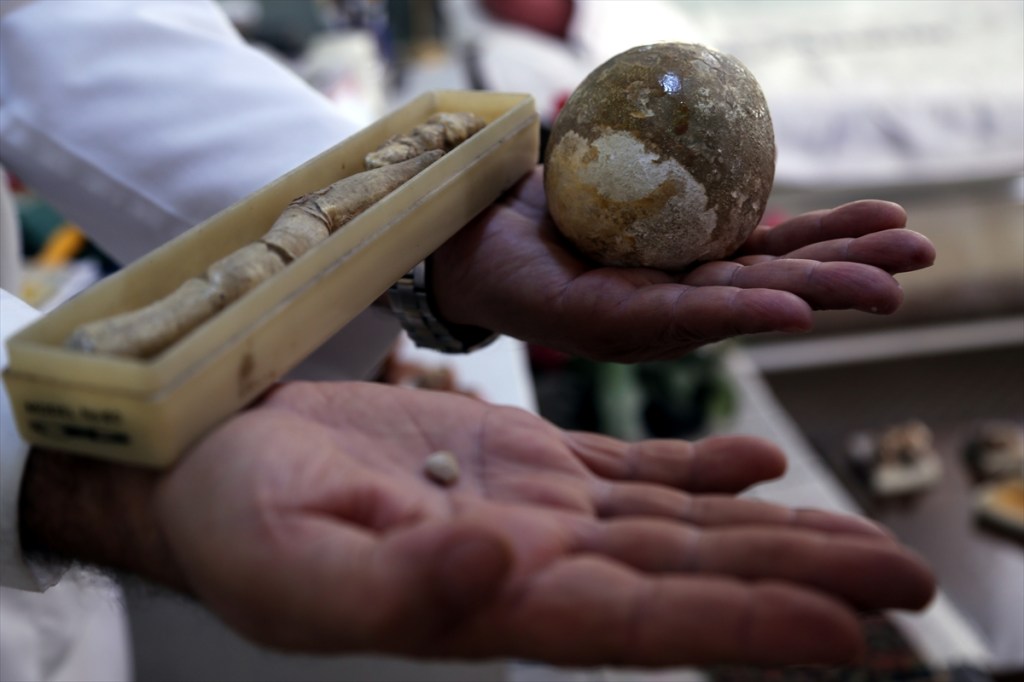 Üroloji Uzmanı İzzetin Zan