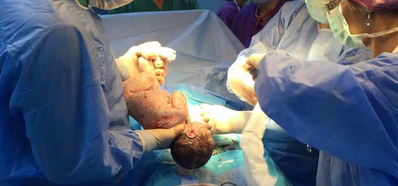 “Sezaryen Oranlarımız Özel Hastanelerde Yüksek, Devlette&nbsp;Normal”